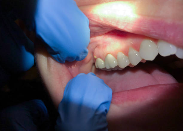 Best Orthodontic Emergency Dentist in Staffd, OR