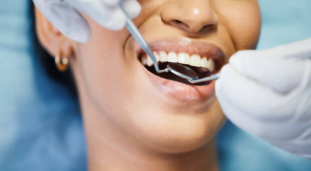 Best Emergency Dentist for Knocked-Out Tooth in Staffd, OR